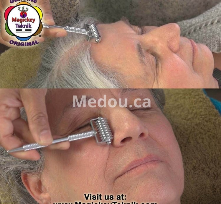 OH-5153 – Rodillo Facial Plateado Magickey Teknik® con Sonda Terapéutica
