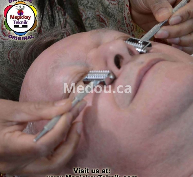 OH-5153 – Rodillo Facial Plateado Magickey Teknik® con Sonda Terapéutica