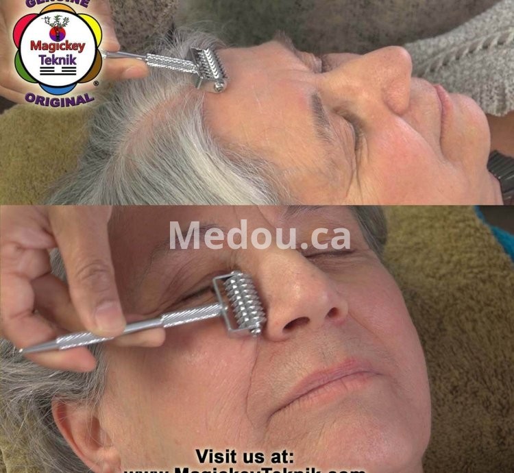 OH-5145 — Rodillo Facial Dorado Magickey Teknik®