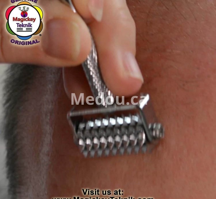 OH-5145 — Rodillo Facial Dorado Magickey Teknik®