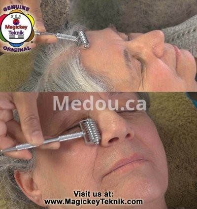 OH-5153 – Rodillo Facial Plateado Magickey Teknik® con Sonda Terapéutica 6