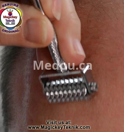 OH-5153 – Rodillo Facial Plateado Magickey Teknik® con Sonda Terapéutica 8