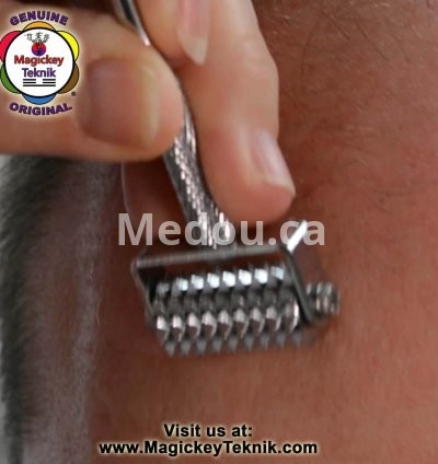 OH-5145 — Rodillo Facial Dorado Magickey Teknik® 12