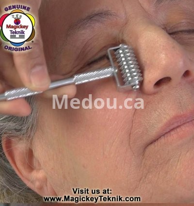 OH-5145 — Rodillo Facial Dorado Magickey Teknik® 13
