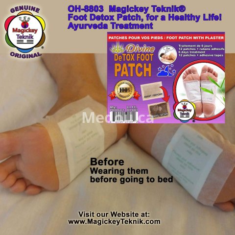 OH-8803 – Magickey Teknik® Divine Detox Foot Patch Treatment
