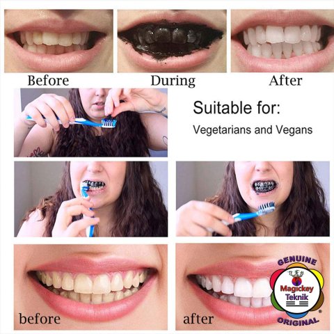 Magickey Teknik® – Polvo blanqueador dental de carbón activado 100 % natural 8