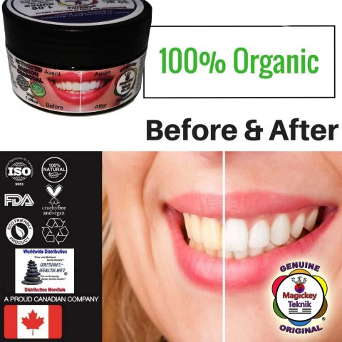 Magickey Teknik® – Polvo blanqueador dental de carbón activado 100 % natural 10