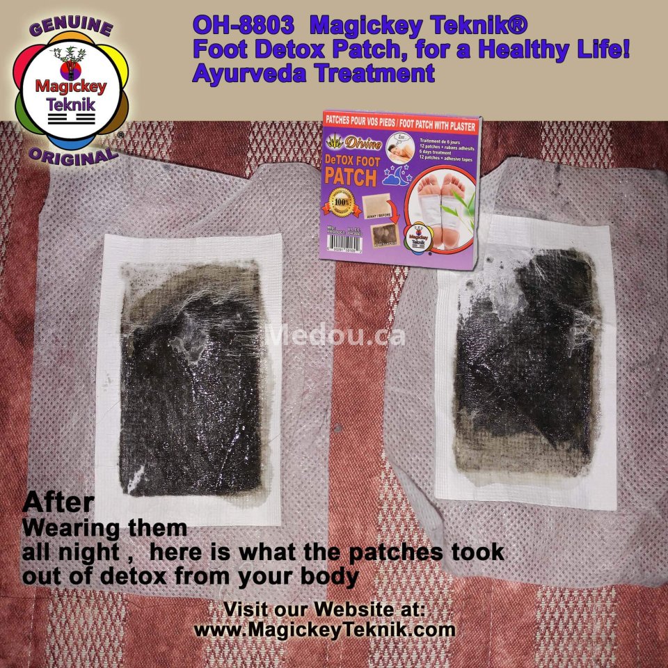 OH-8803 – Magickey Teknik® Divine Detox Foot Patch Treatment