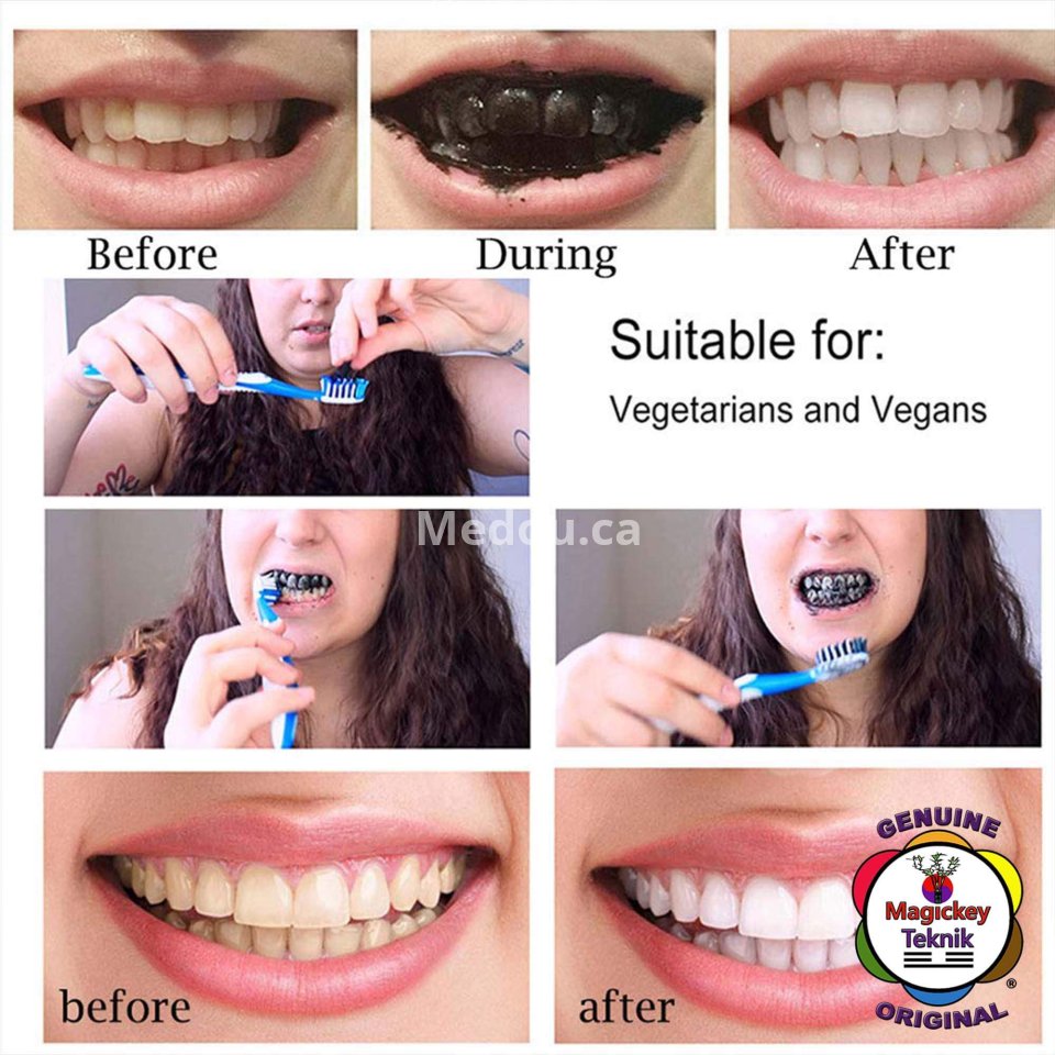 Magickey Teknik® – Polvo blanqueador dental de carbón activado 100 % natural